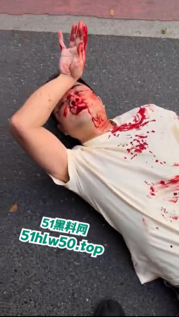 广东潮汕暴躁男在线作死，只因未戴头盔强行躲检撞飞交警双双倒地不起满脸是伤！  第3张