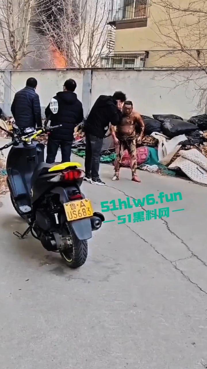 山东济南一小区发生火灾，男子被烧的体无完肤，经调查是邻居大妈积攒的废品导致烧成这样也太惨了。  第1张