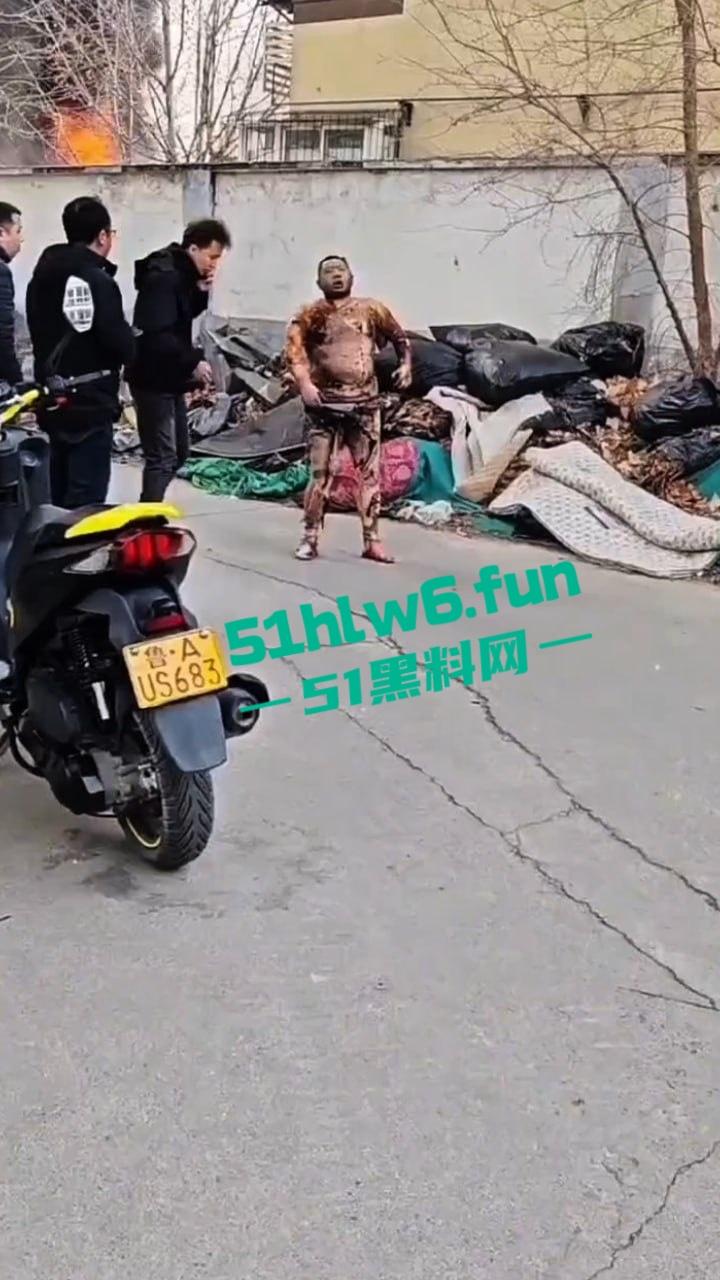 山东济南一小区发生火灾，男子被烧的体无完肤，经调查是邻居大妈积攒的废品导致烧成这样也太惨了。  第2张