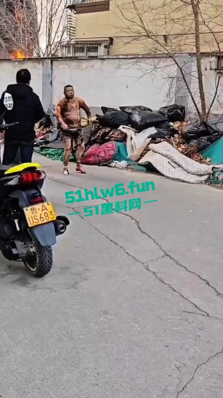 山东济南一小区发生火灾，男子被烧的体无完肤，经调查是邻居大妈积攒的废品导致烧成这样也太惨了。  第4张