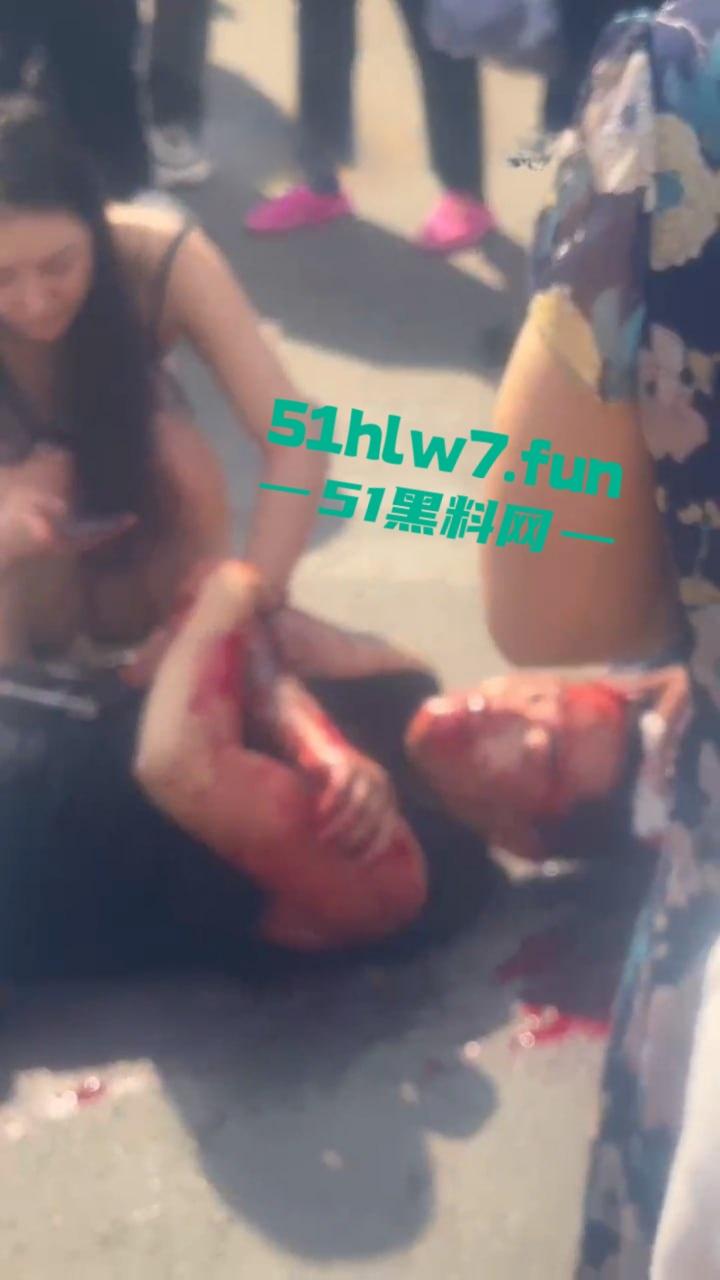 情侣街头误惹地痞流氓惨遭群殴,女友拼命拉架奈何小伙还是被砍数刀大街上躺板板。 第7张 情侣街头误惹地痞流氓惨遭群殴,女友拼命拉架奈何小伙还是被砍数刀大街上躺板板。 第7张