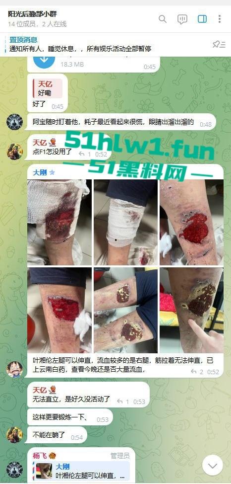 网友爆料:东南亚最黑暗的公司没有之一,妙瓦底七号山庄【阳光集团】管理群殴公司员工视频,聊天记录及老板马亿被扒。 第7张 网友爆料:东南亚最黑暗的公司没有之一,妙瓦底七号山庄【阳光集团】管理群殴公司员工视频,聊天记录及老板马亿被扒。 第7张