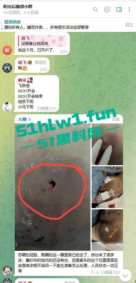 网友爆料:东南亚最黑暗的公司没有之一,妙瓦底七号山庄【阳光集团】管理群殴公司员工视频,聊天记录及老板马亿被扒。 第14张 网友爆料:东南亚最黑暗的公司没有之一,妙瓦底七号山庄【阳光集团】管理群殴公司员工视频,聊天记录及老板马亿被扒。 第14张