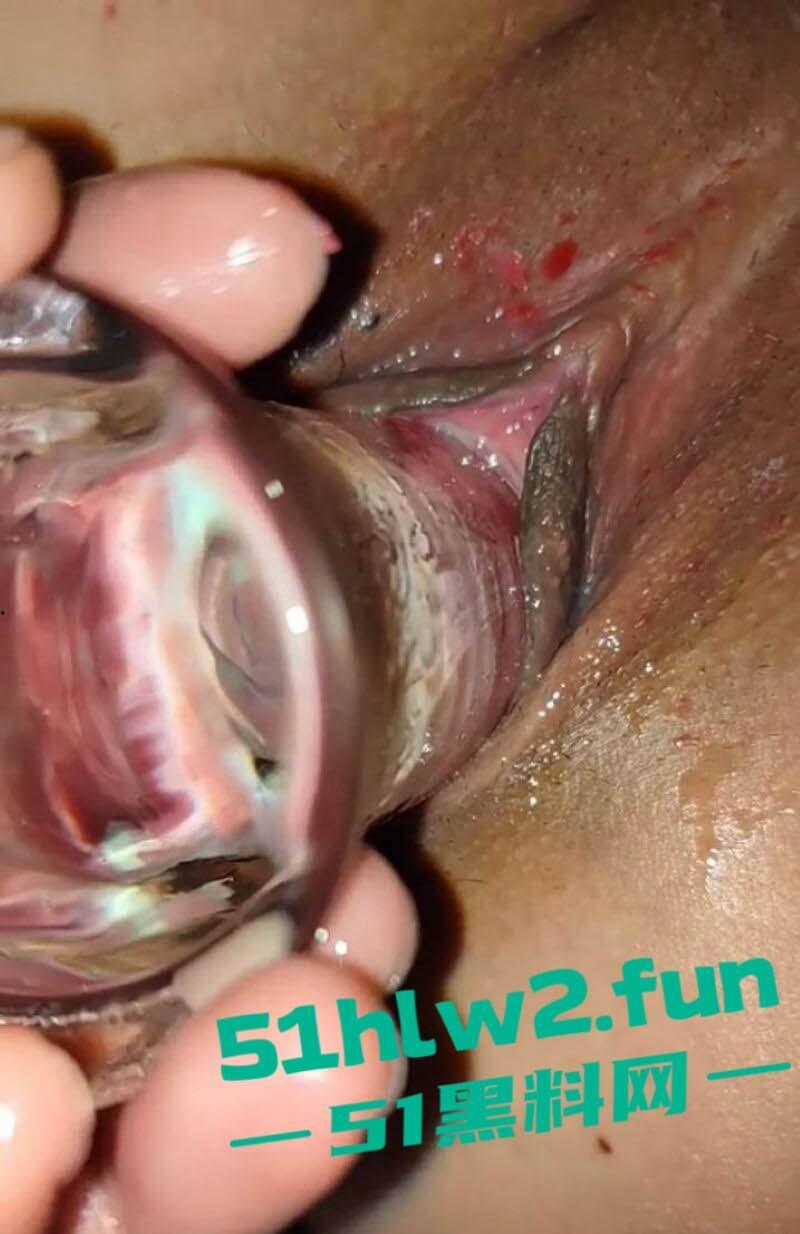 情人节最狂热瓜,JK黑丝清纯妹子玩SM爽了,一边被炮机狂抽一边往逼上滴红色燃料,还嫌不够刺激,再加一根按摩棒! 第1张 情人节最狂热瓜,JK黑丝清纯妹子玩SM爽了,一边被炮机狂抽一边往逼上滴红色燃料,还嫌不够刺激,再加一根按摩棒! 第1张