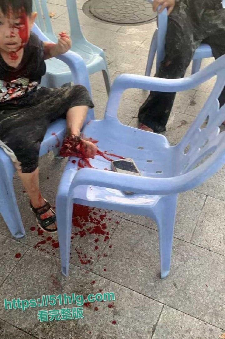 疯狂纵火撞学校！【福建漳州云霄县】司机骇人行径震惊众人，多名学生受伤  现场一片血肉横飞惨象 第5张