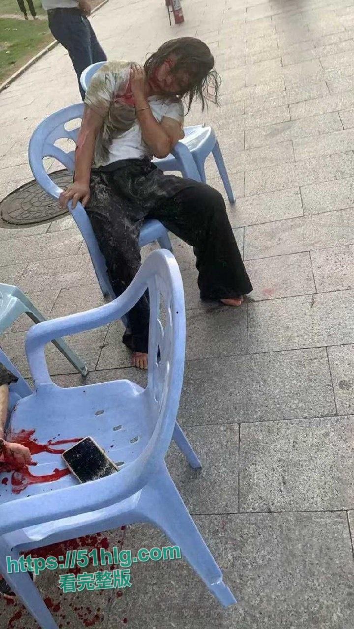 疯狂纵火撞学校！【福建漳州云霄县】司机骇人行径震惊众人，多名学生受伤  现场一片血肉横飞惨象 第7张