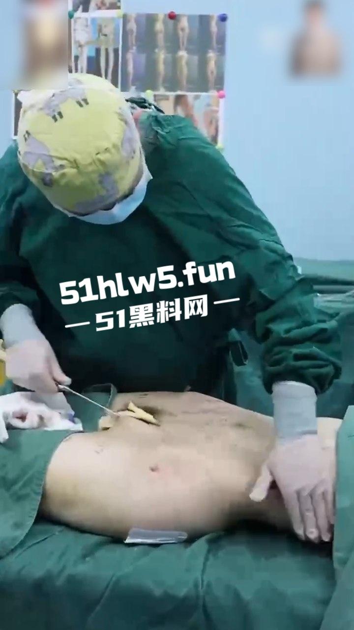 实拍整形医院，小仙女整容抽脂和填充全过程，看着残忍但做完后惊艳的效果让人震撼。  第2张