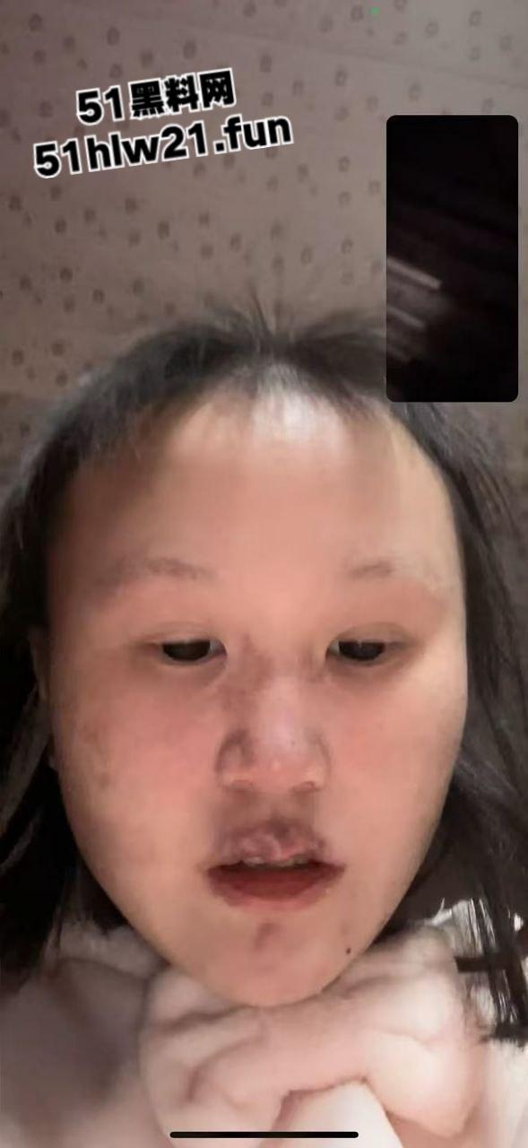 重庆生化母体【刘思婷】美化身份装女神到处卖骚，体生烂疮还继续约炮散毒。  第9张