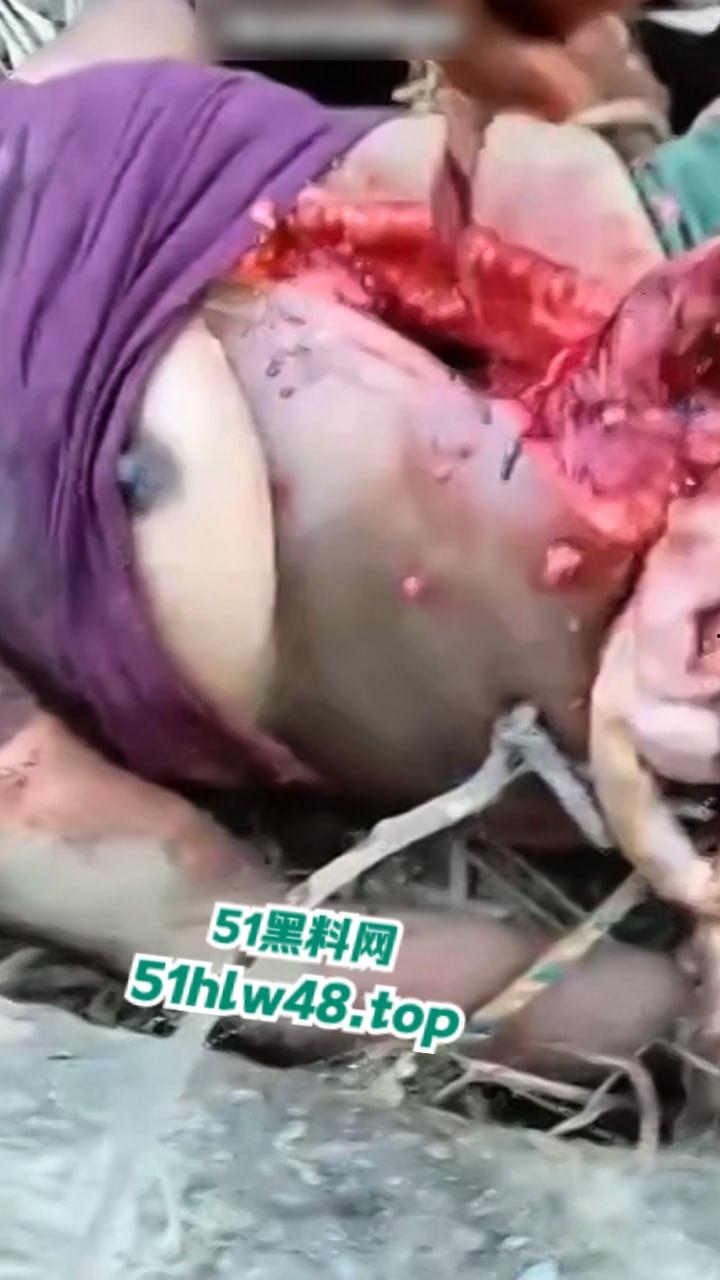 【恐怖血腥】国外大奶美女剖尸现场视频，大坨内脏被扯出，大奶美女和肥猪没啥区别。  第5张