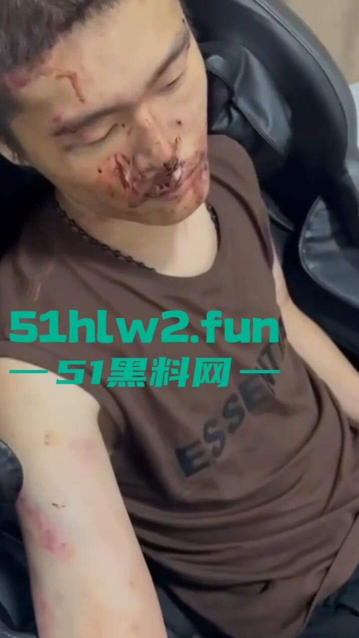 园区猪仔真实近况,绑架后只有受虐的份,电击殴打口吐鲜血境外没有高薪工作,只有无尽的折磨。 第5张 园区猪仔真实近况,绑架后只有受虐的份,电击殴打口吐鲜血境外没有高薪工作,只有无尽的折磨。 第5张