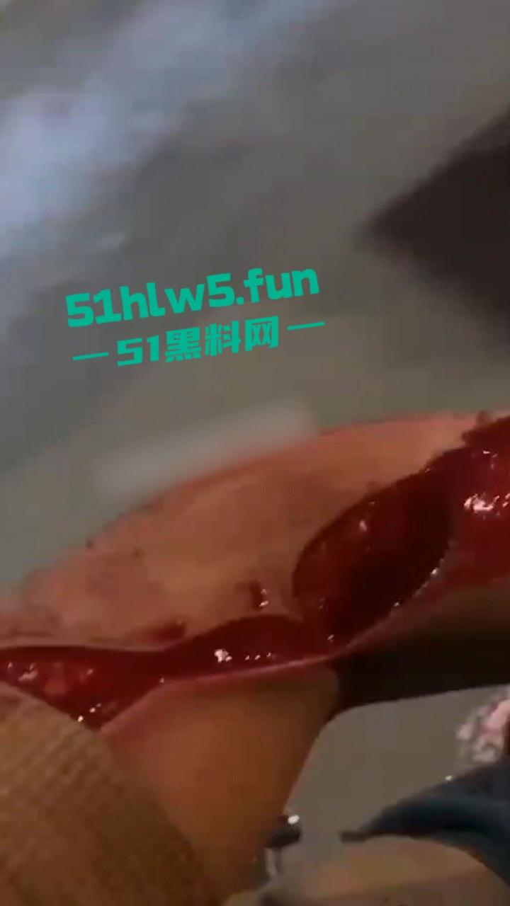 重口血腥场面慎点!广东普宁cw电竞社精神小伙线下真实暴砍对手致皮开肉绽。 第3张 重口血腥场面慎点!广东普宁cw电竞社精神小伙线下真实暴砍对手致皮开肉绽。 第3张