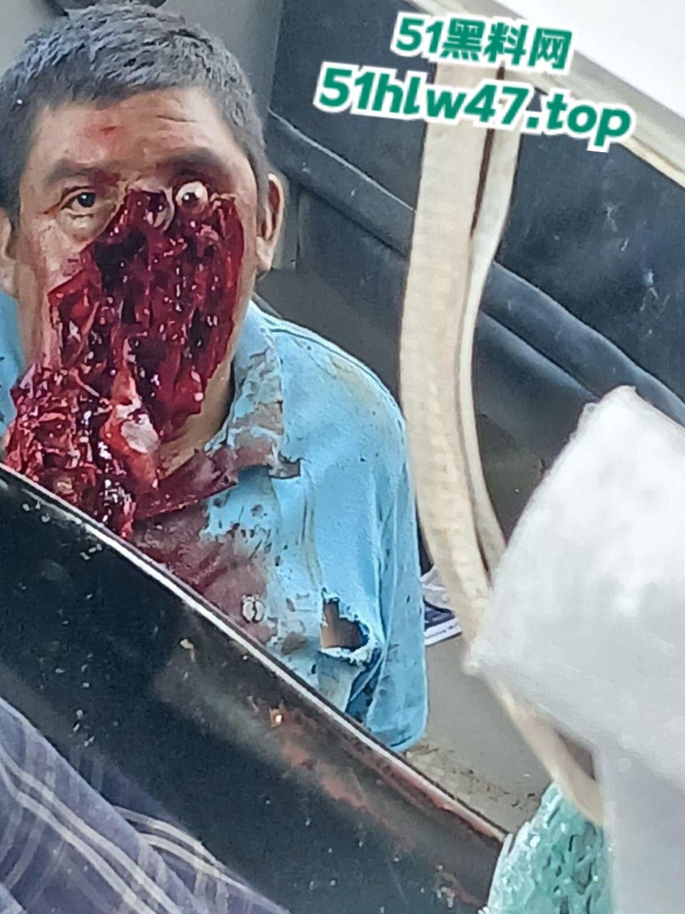 【血腥恐怖】印尼发生惨烈车祸,超速行驶失控后撞上前方货车,导致多人死亡司机直接面目全非。 第4张 【血腥恐怖】印尼发生惨烈车祸,超速行驶失控后撞上前方货车,导致多人死亡司机直接面目全非。 第4张