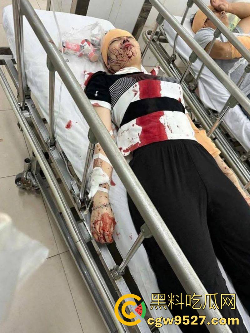 越南海防水果批发市场，发生重大砍人事件，男子手持菜刀疯狂劈砍，导致三人身受重伤，现场视频流出！  第1张