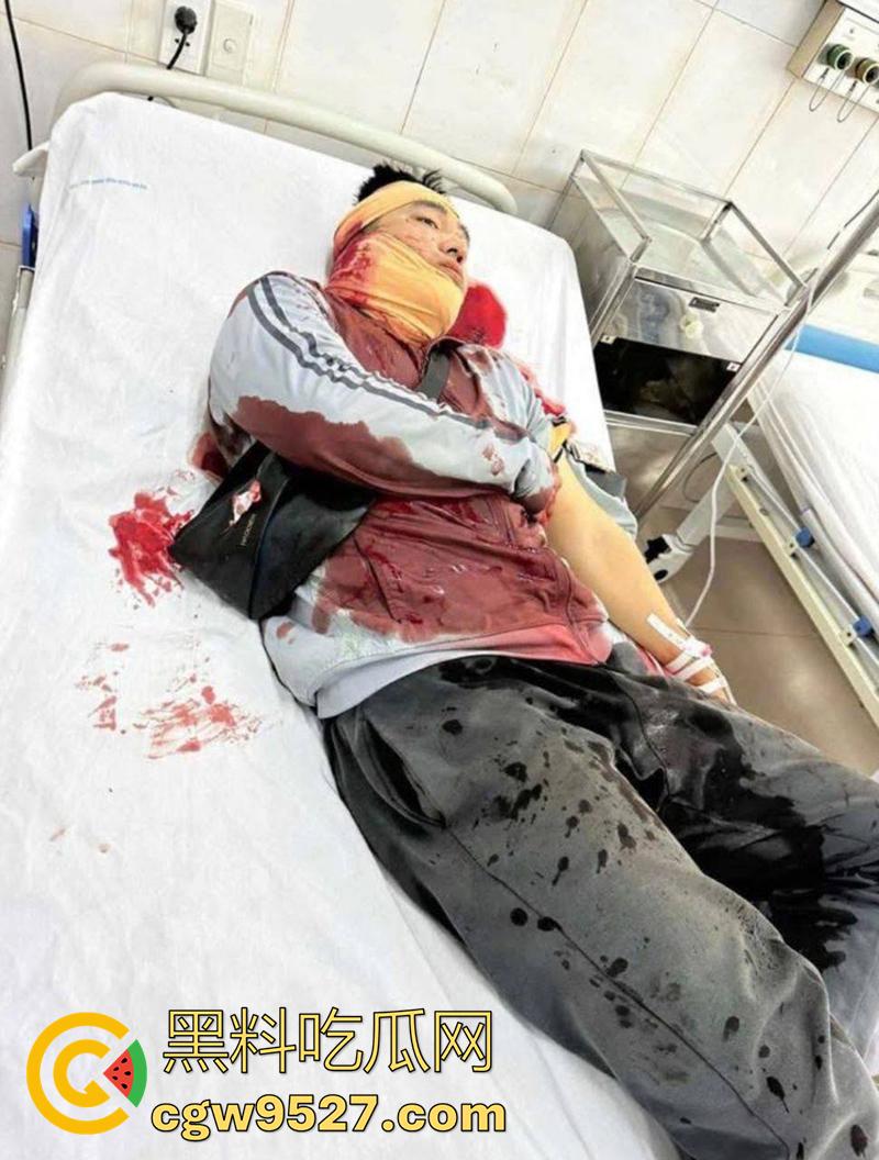 越南海防水果批发市场，发生重大砍人事件，男子手持菜刀疯狂劈砍，导致三人身受重伤，现场视频流出！  第2张