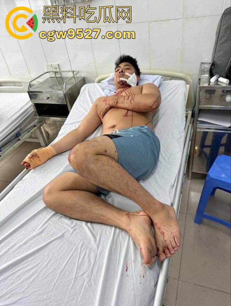 越南海防水果批发市场，发生重大砍人事件，男子手持菜刀疯狂劈砍，导致三人身受重伤，现场视频流出！  第4张