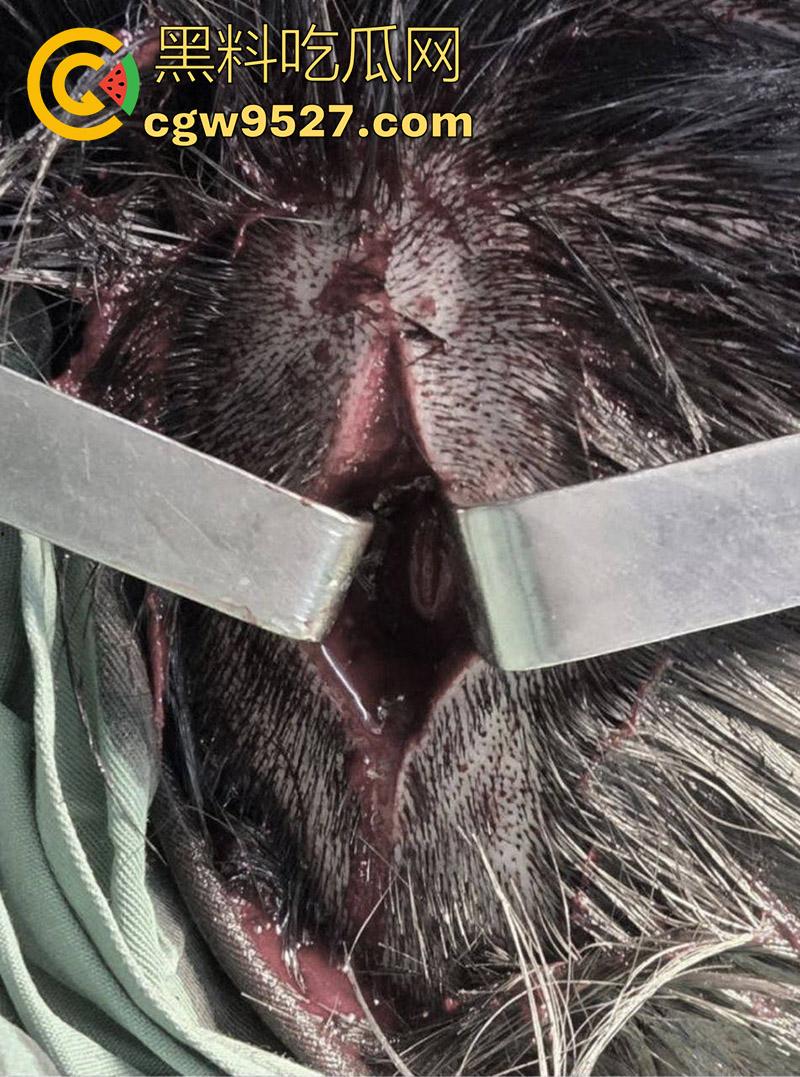 越南海防水果批发市场，发生重大砍人事件，男子手持菜刀疯狂劈砍，导致三人身受重伤，现场视频流出！  第5张