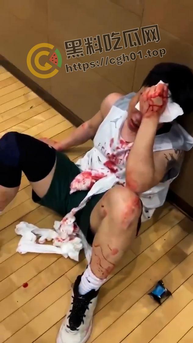 一场野球挣了66w！广州汇悦台野球场暴躁男【王帅】打球带肘给人开瓢  赔66w才能免坐牢 第4张