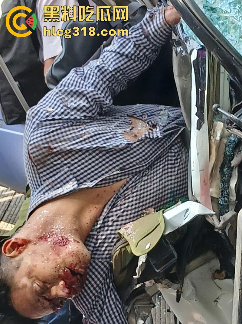 车祸没死脸却没了！印尼发生惨烈车祸，超速行驶失控撞上货车，乘客全部死亡司机面目全非！  第7张