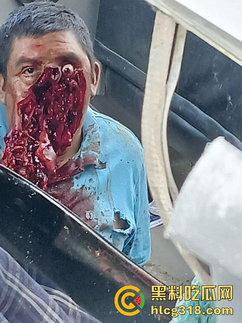 车祸没死脸却没了！印尼发生惨烈车祸，超速行驶失控撞上货车，乘客全部死亡司机面目全非！  第8张