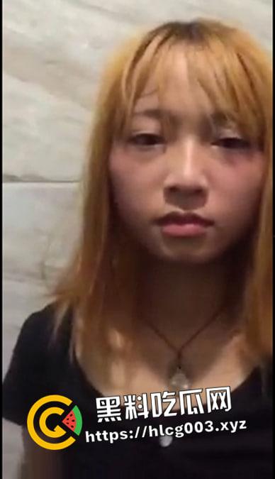 精神小妹酸奶倒进逼里  不自慰就被打 脸和逼都被打肿了 现场视频流出 第1张