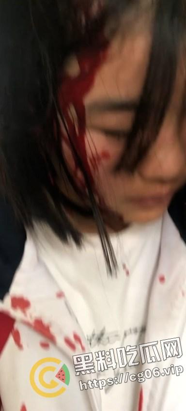 霸凌合集! 群殴暴打 强迫虐阴  是人性扭曲还是环境所迫？（十四） 第9张