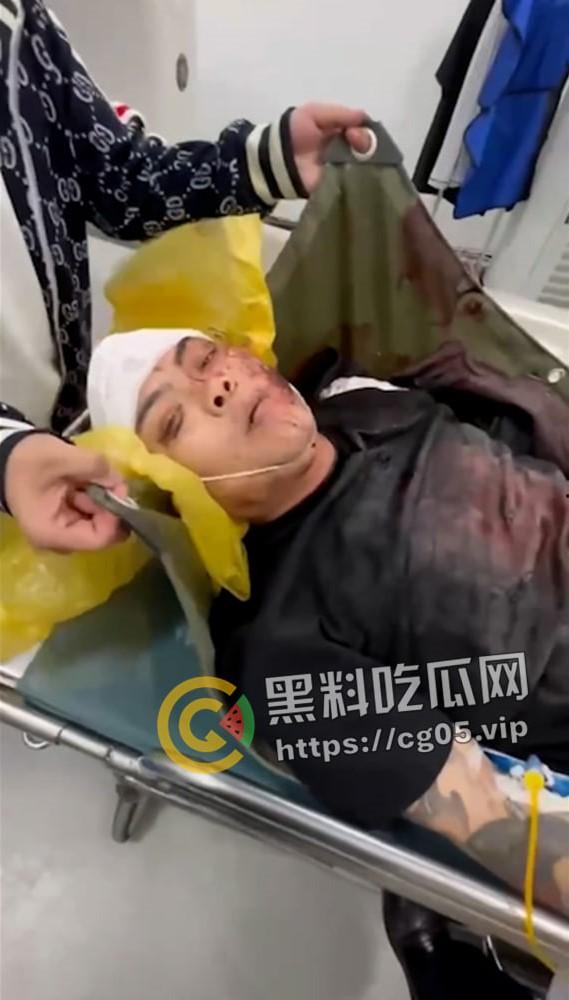 精神小伙哈尔滨斯卡拉迪厅前挑衅!上一秒嚣张至极 下一秒被打成猪头 活该 第5张 精神小伙哈尔滨斯卡拉迪厅前挑衅!上一秒嚣张至极 下一秒被打成猪头 活该 第5张