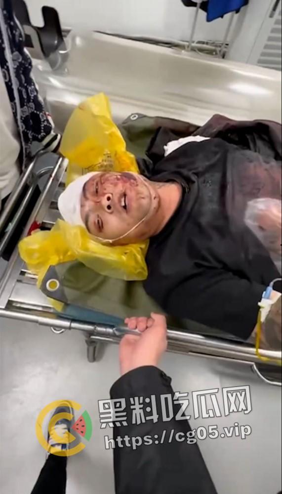 精神小伙哈尔滨斯卡拉迪厅前挑衅!上一秒嚣张至极 下一秒被打成猪头 活该 第6张 精神小伙哈尔滨斯卡拉迪厅前挑衅!上一秒嚣张至极 下一秒被打成猪头 活该 第6张