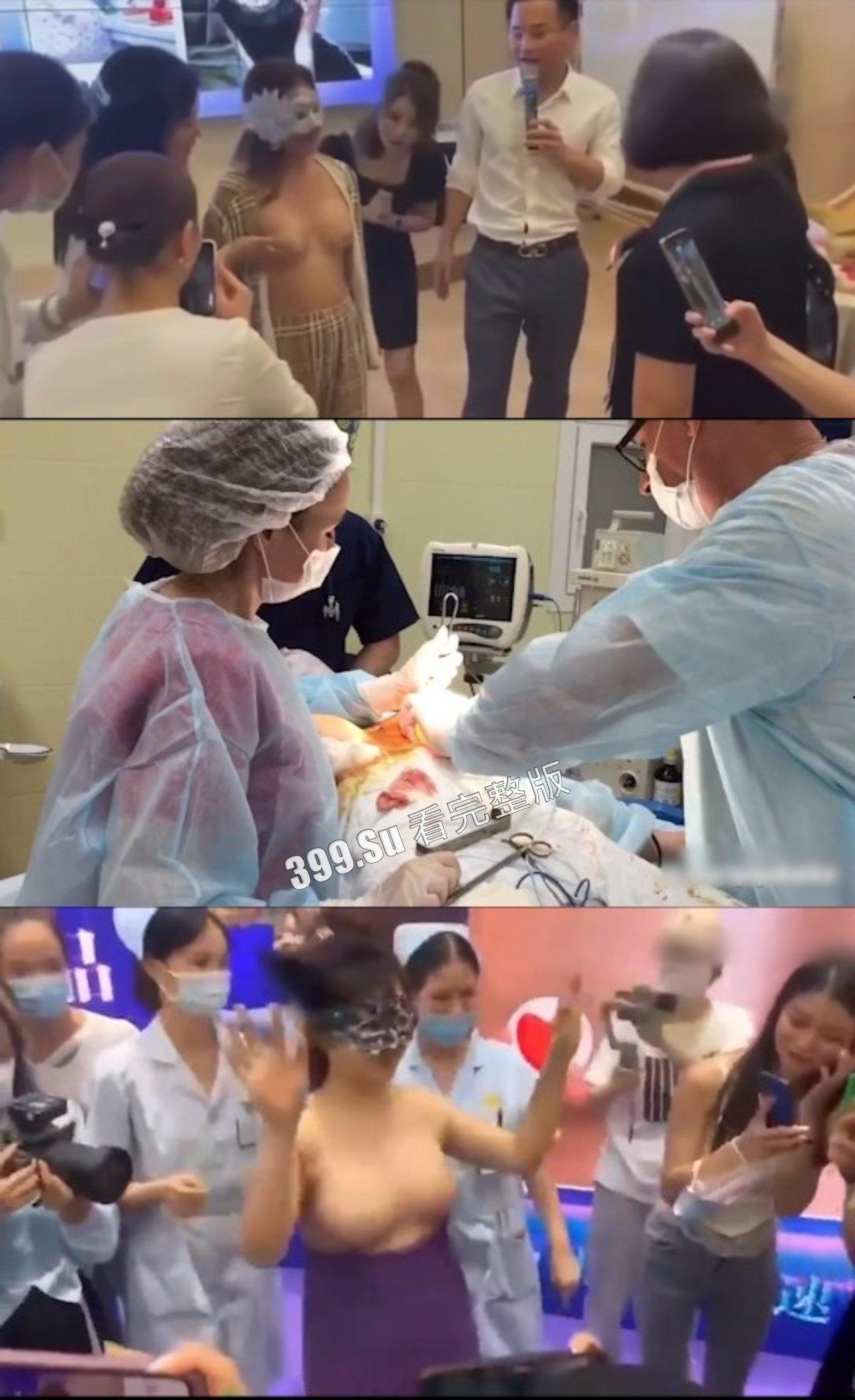 医美整形那些事儿 假的真不了  女人对自己真狠 阴唇黑了就直接切掉 （二） 第2张