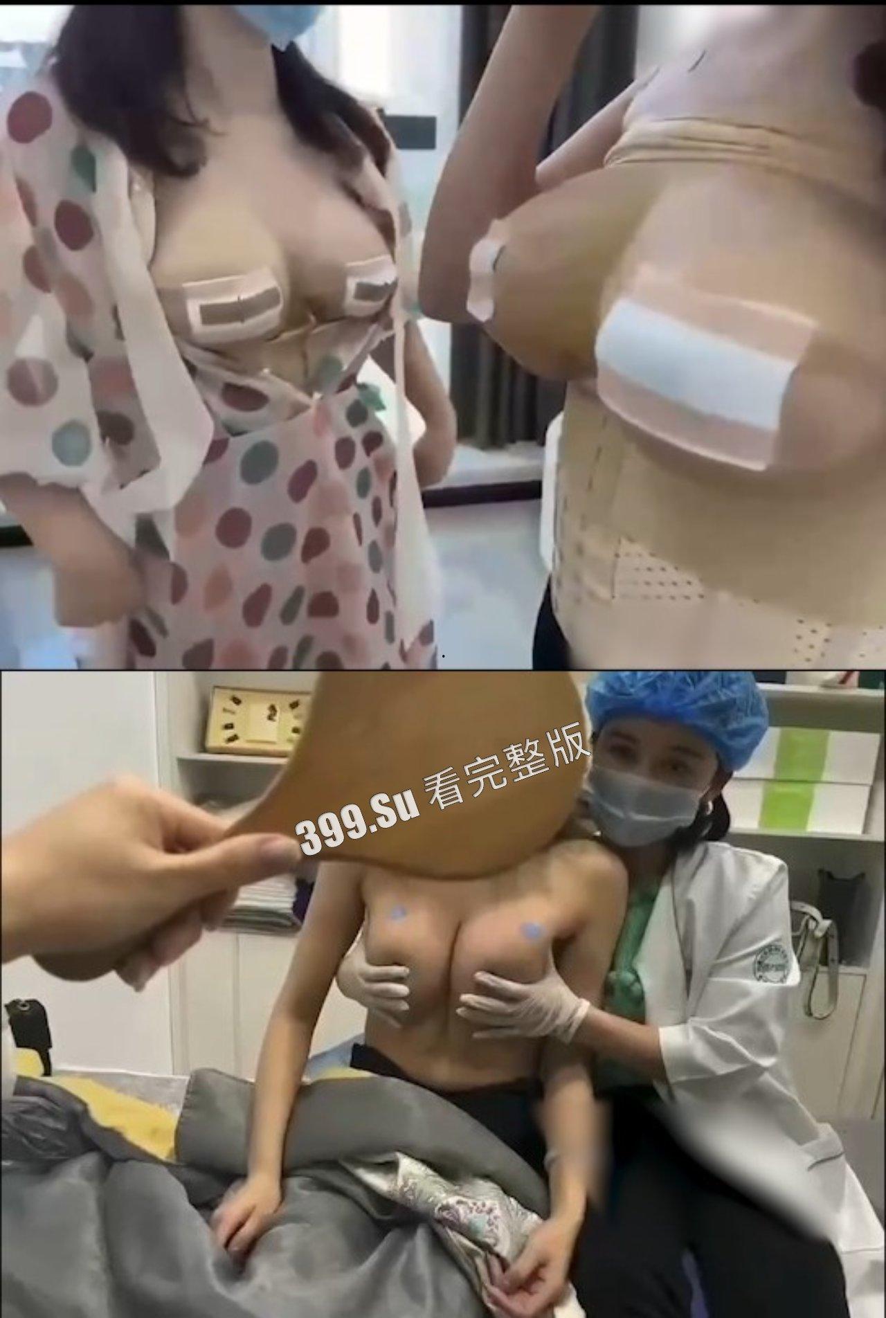 医美整形那些事儿 假的真不了  女人对自己真狠 阴唇黑了就直接切掉 （二） 第4张