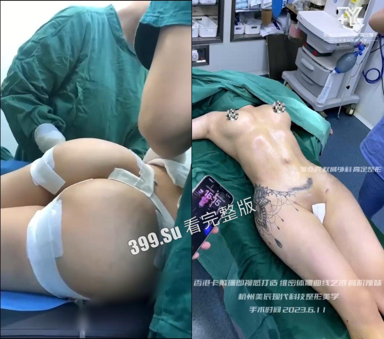 医美整形那些事儿 假的真不了  女人对自己真狠 阴唇黑了就直接切掉 （二） 第5张