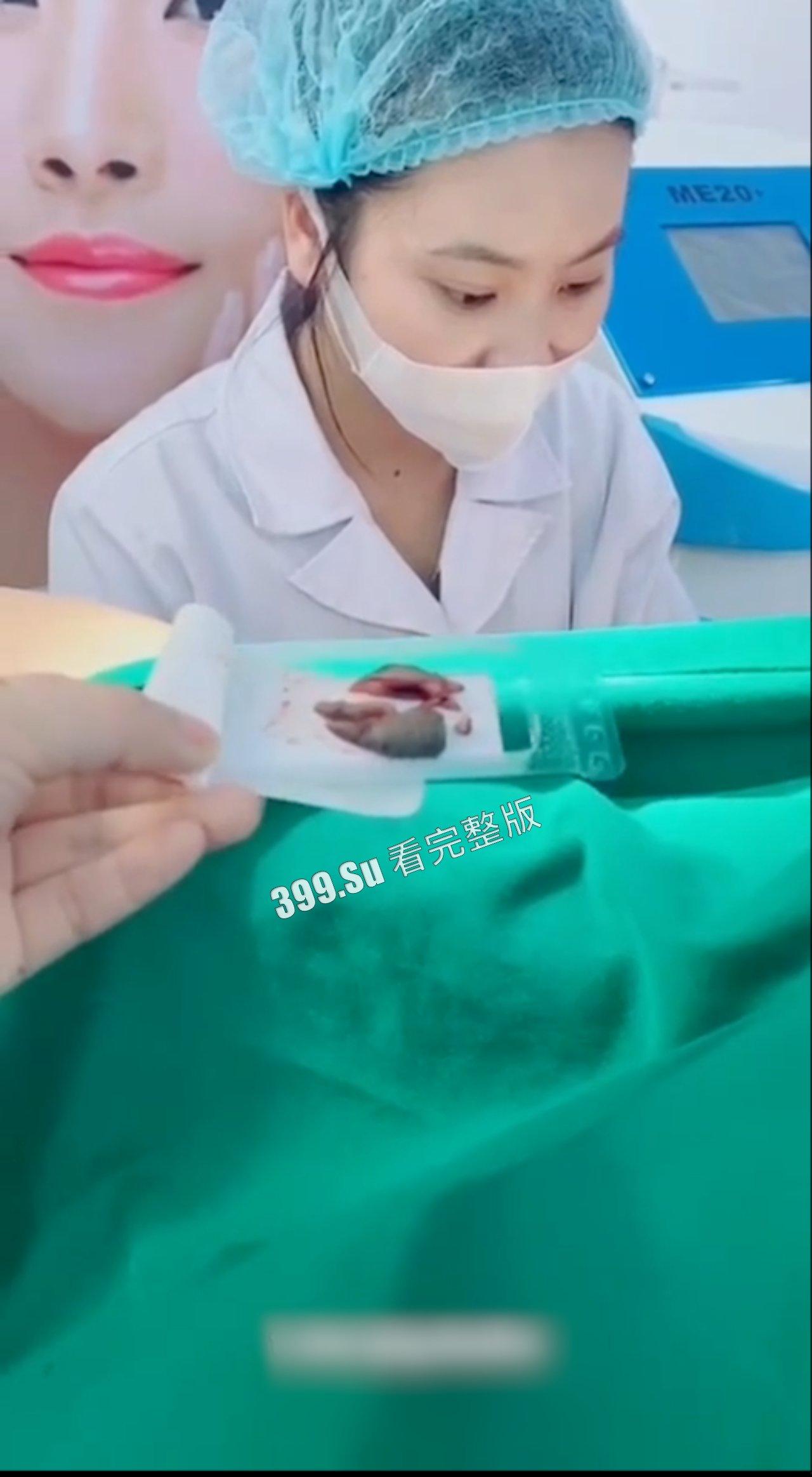 医美整形那些事儿 假的真不了  女人对自己真狠 阴唇黑了就直接切掉 （二） 第9张