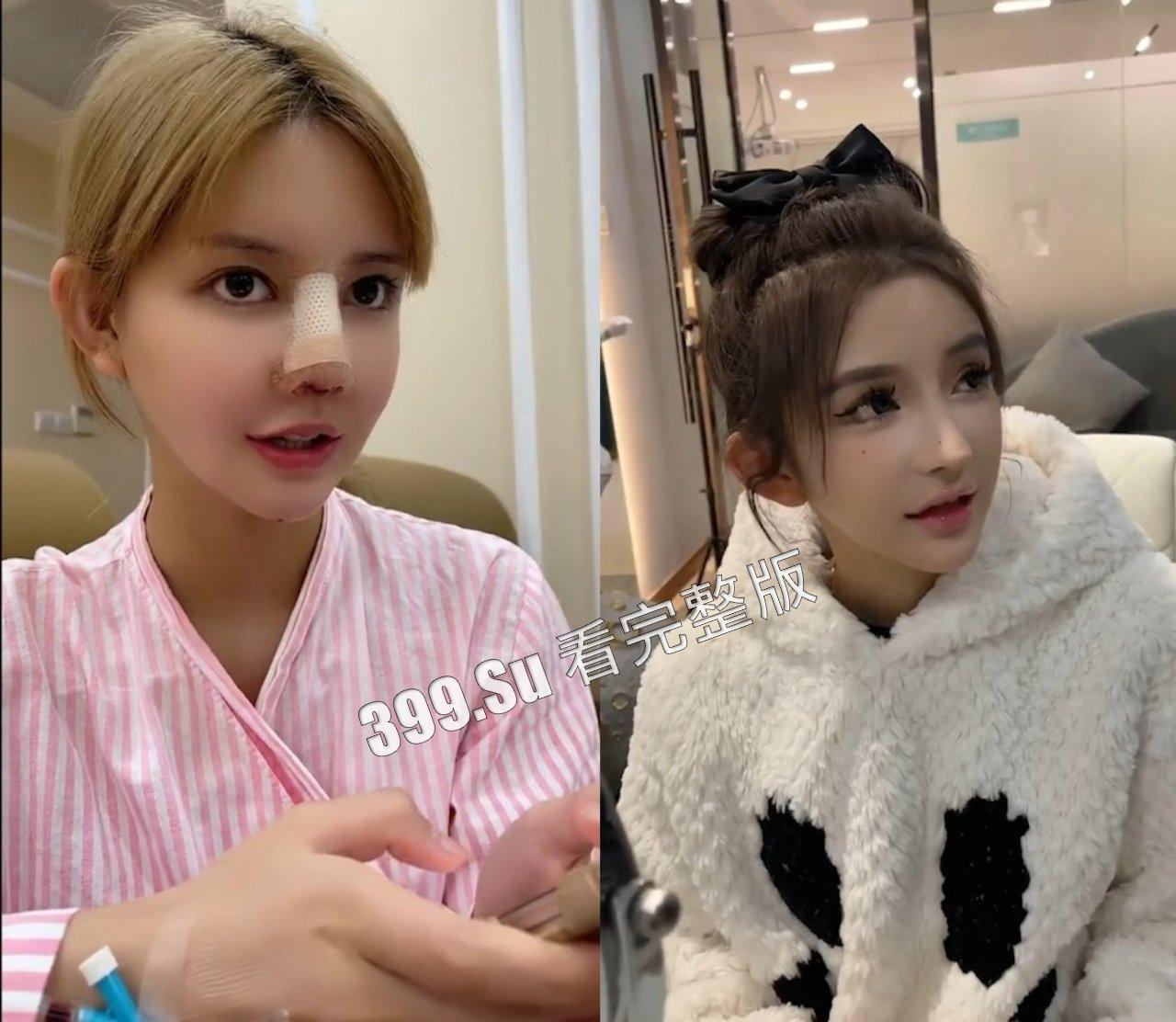 医美整形那些事儿  假的真不了 瓜友们能在生活中分辨出人造人吗？ 第2张