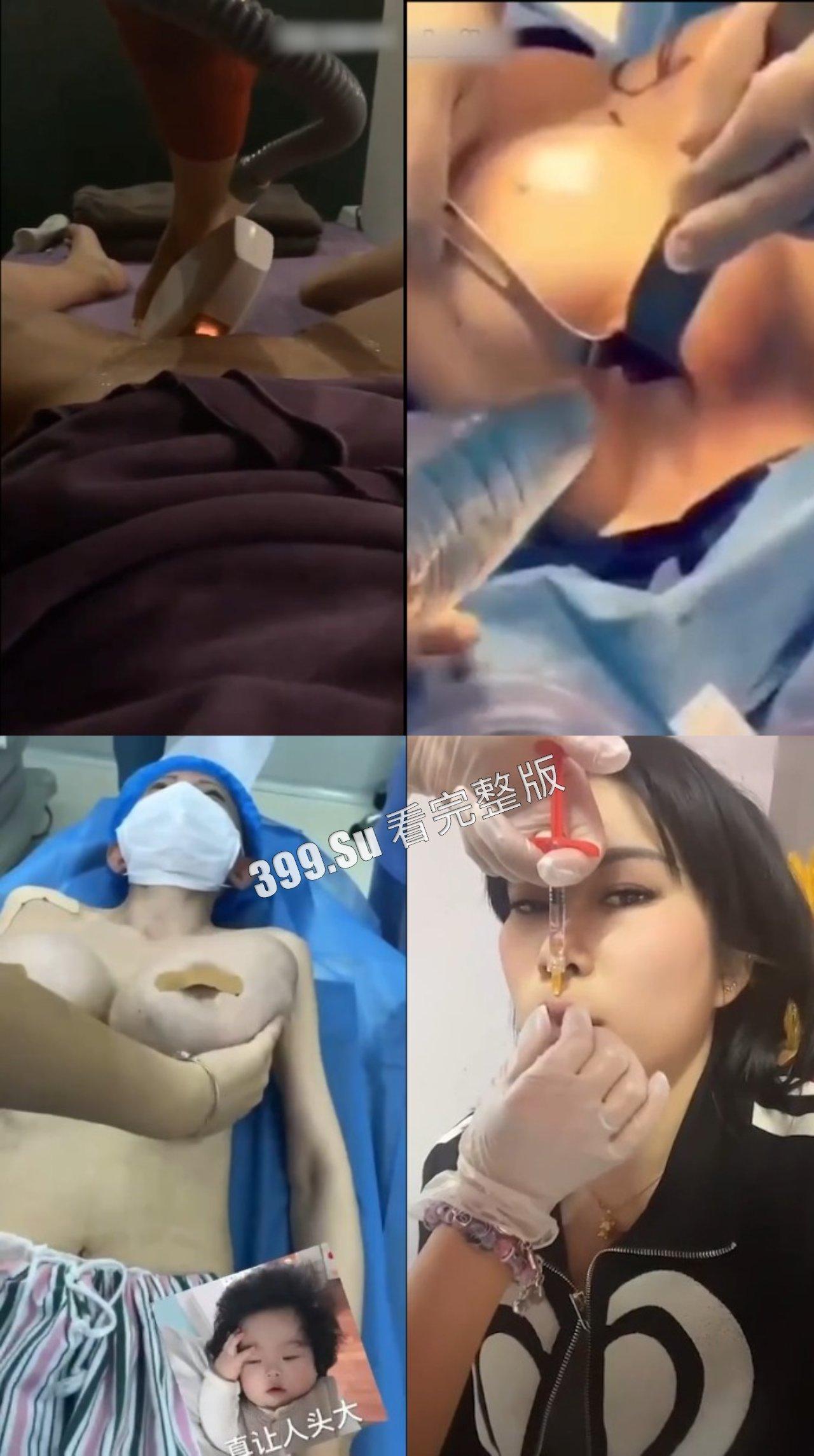 医美整形那些事儿  假的真不了 瓜友们能在生活中分辨出人造人吗？ 第9张