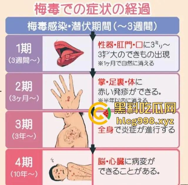 梅毒像疯狗一样乱咬！日本疫情横扫全球，日本卫生部出狠招断根大法安排上，管不住下半身只能禁爱？  第10张