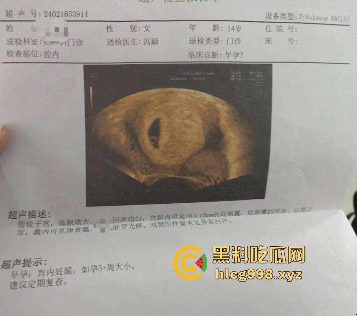 不到18岁小姑娘竟然怀孕！不带套灌满精液，爽完直接奔着5代同堂，真是绝了！  第7张