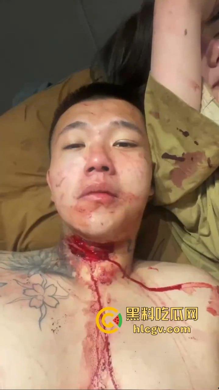 朋友圈成了血腥展示场？王湳权手刃女友后发朋友圈，画面直击心灵，血腥内容慎入！  第13张