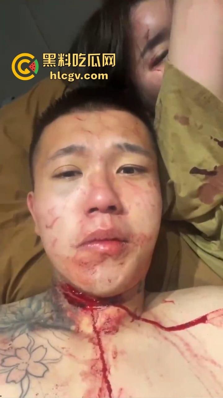 朋友圈成了血腥展示场？王湳权手刃女友后发朋友圈，画面直击心灵，血腥内容慎入！  第14张