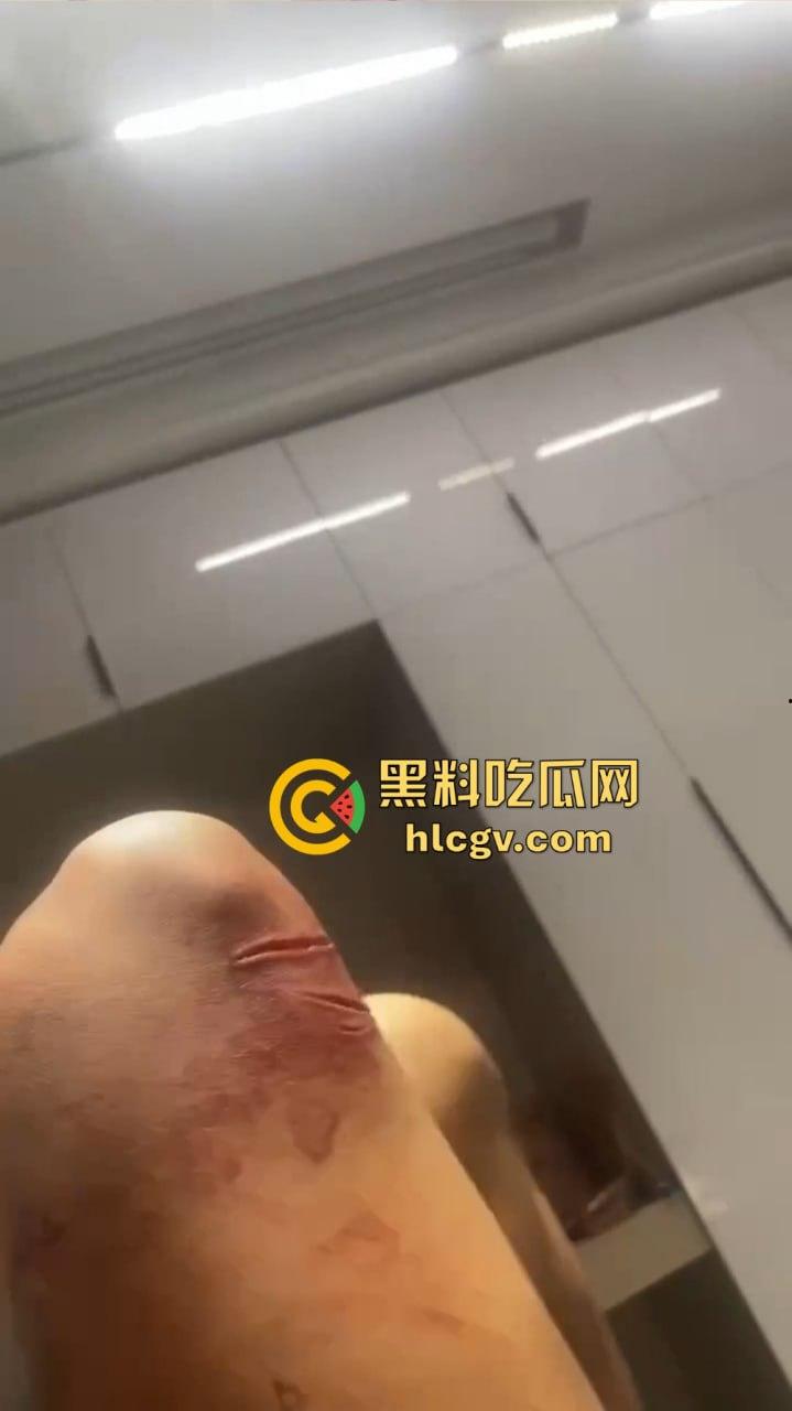 朋友圈成了血腥展示场？王湳权手刃女友后发朋友圈，画面直击心灵，血腥内容慎入！  第15张