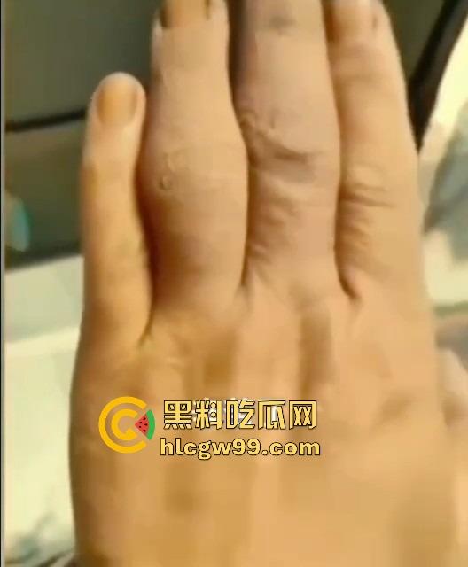 广州护士实习生『蓝美淇』开学前急约一炮，轻微洁癖却爱被抠逼，抠到手水肿，这逼是真湿还是有毒？  第11张