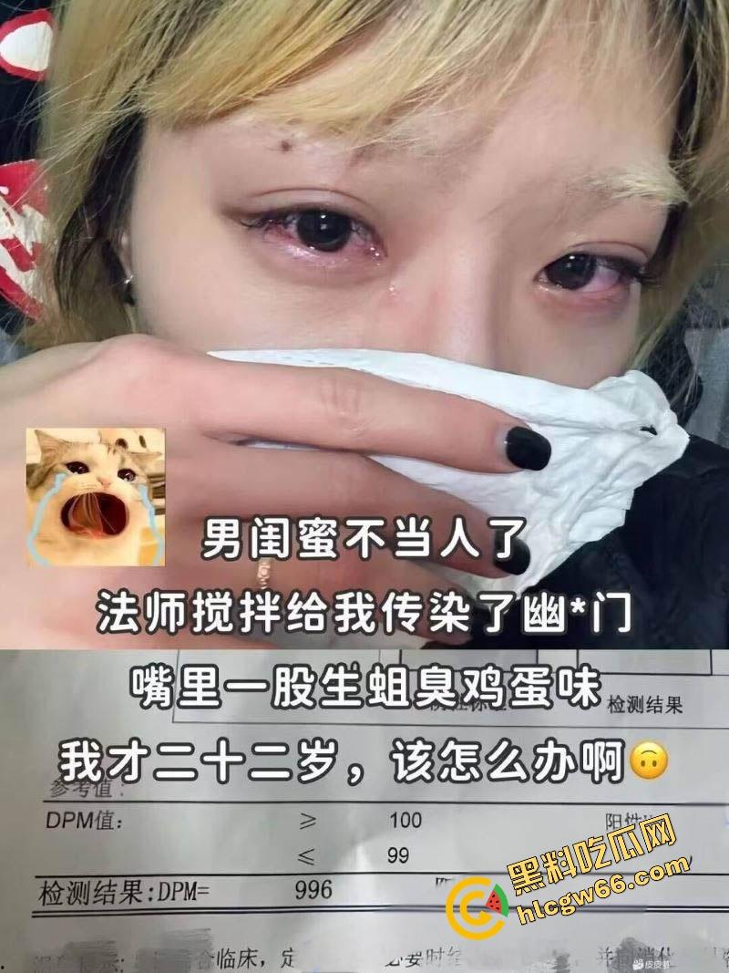 22岁美女被男闺蜜干爆肛后立马口交吃自己屎，惨遭幽门螺杆菌入侵，嘴里臭过粪坑，这操作太逆天！  第1张