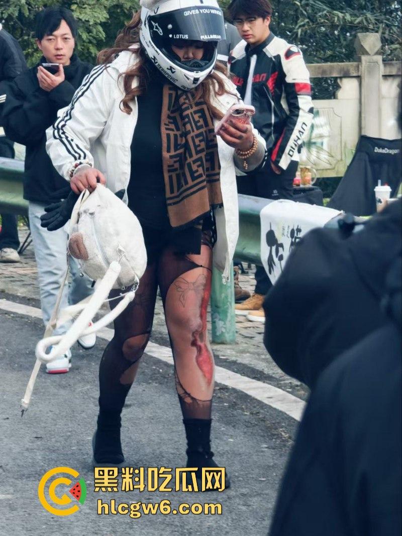 美图秀秀弱爆了 这才是真实磨皮!胖妹装逼压弯失控撞车 黑丝当场爆裂惨遭磨皮 大腿血肉模糊 真是悲惨又丢人! 第4张 美图秀秀弱爆了 这才是真实磨皮!胖妹装逼压弯失控撞车 黑丝当场爆裂惨遭磨皮 大腿血肉模糊 真是悲惨又丢人! 第4张