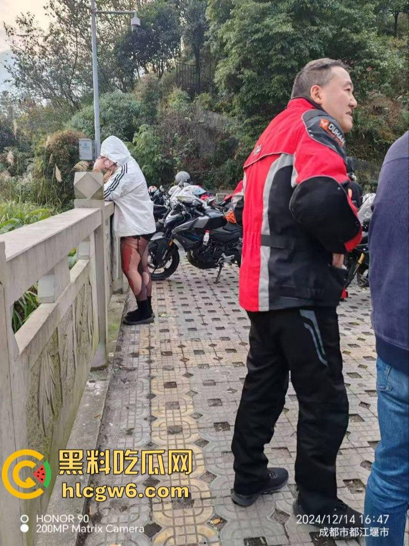 美图秀秀弱爆了 这才是真实磨皮!胖妹装逼压弯失控撞车 黑丝当场爆裂惨遭磨皮 大腿血肉模糊 真是悲惨又丢人! 第6张 美图秀秀弱爆了 这才是真实磨皮!胖妹装逼压弯失控撞车 黑丝当场爆裂惨遭磨皮 大腿血肉模糊 真是悲惨又丢人! 第6张