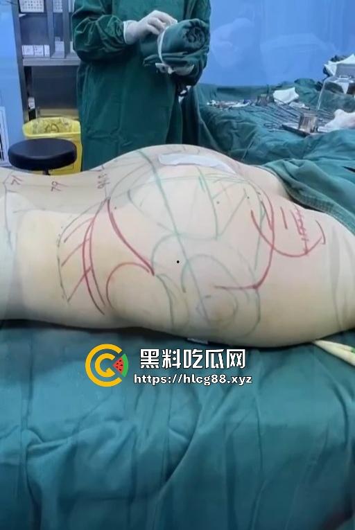 现在妹子为美疯魔抽脂隆奶塞逼艾灸,骚穴子宫烤得喷香,医美变态到艾灸鸡巴都出现了! 第10张 现在妹子为美疯魔抽脂隆奶塞逼艾灸,骚穴子宫烤得喷香,医美变态到艾灸鸡巴都出现了! 第10张