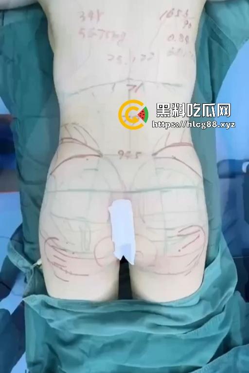 现在妹子为美疯魔抽脂隆奶塞逼艾灸,骚穴子宫烤得喷香,医美变态到艾灸鸡巴都出现了! 第11张 现在妹子为美疯魔抽脂隆奶塞逼艾灸,骚穴子宫烤得喷香,医美变态到艾灸鸡巴都出现了! 第11张