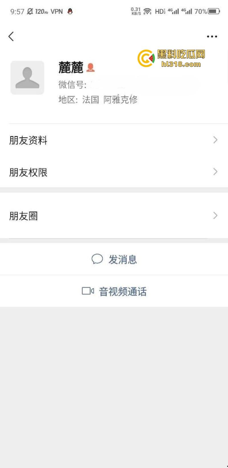 极品巨乳学生妹【林麓】网调视频曝光,背男友拍露脸自慰视频约炮金主,湿漉嫩逼与巨乳一览无余! 第1张 极品巨乳学生妹【林麓】网调视频曝光,背男友拍露脸自慰视频约炮金主,湿漉嫩逼与巨乳一览无余! 第1张
