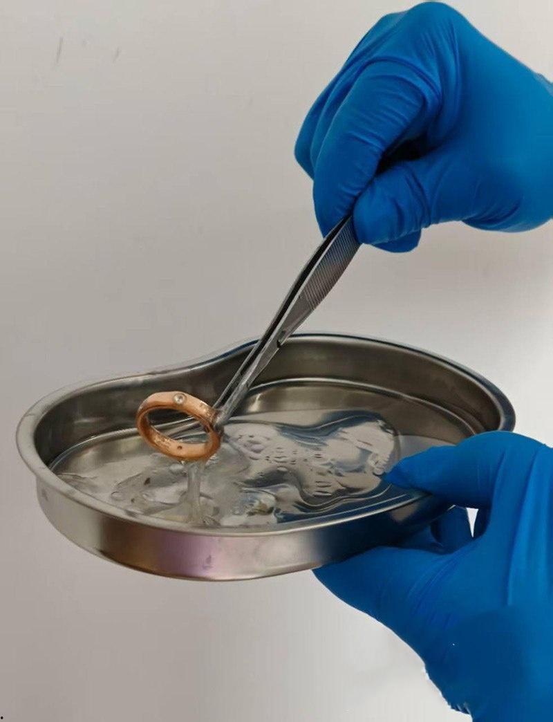 真刺激!男模激情拳交玩过火,结果金戒指卡屁眼里,深夜紧急送医取出,医生直叹牛逼 第7张 真刺激!男模激情拳交玩过火,结果金戒指卡屁眼里,深夜紧急送医取出,医生直叹牛逼 第7张