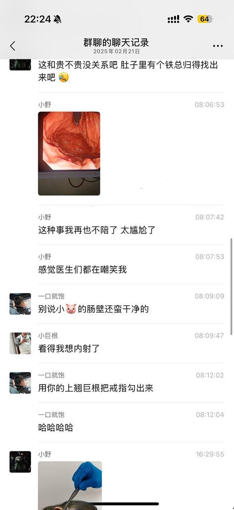 真刺激!男模激情拳交玩过火,结果金戒指卡屁眼里,深夜紧急送医取出,医生直叹牛逼 第10张 真刺激!男模激情拳交玩过火,结果金戒指卡屁眼里,深夜紧急送医取出,医生直叹牛逼 第10张