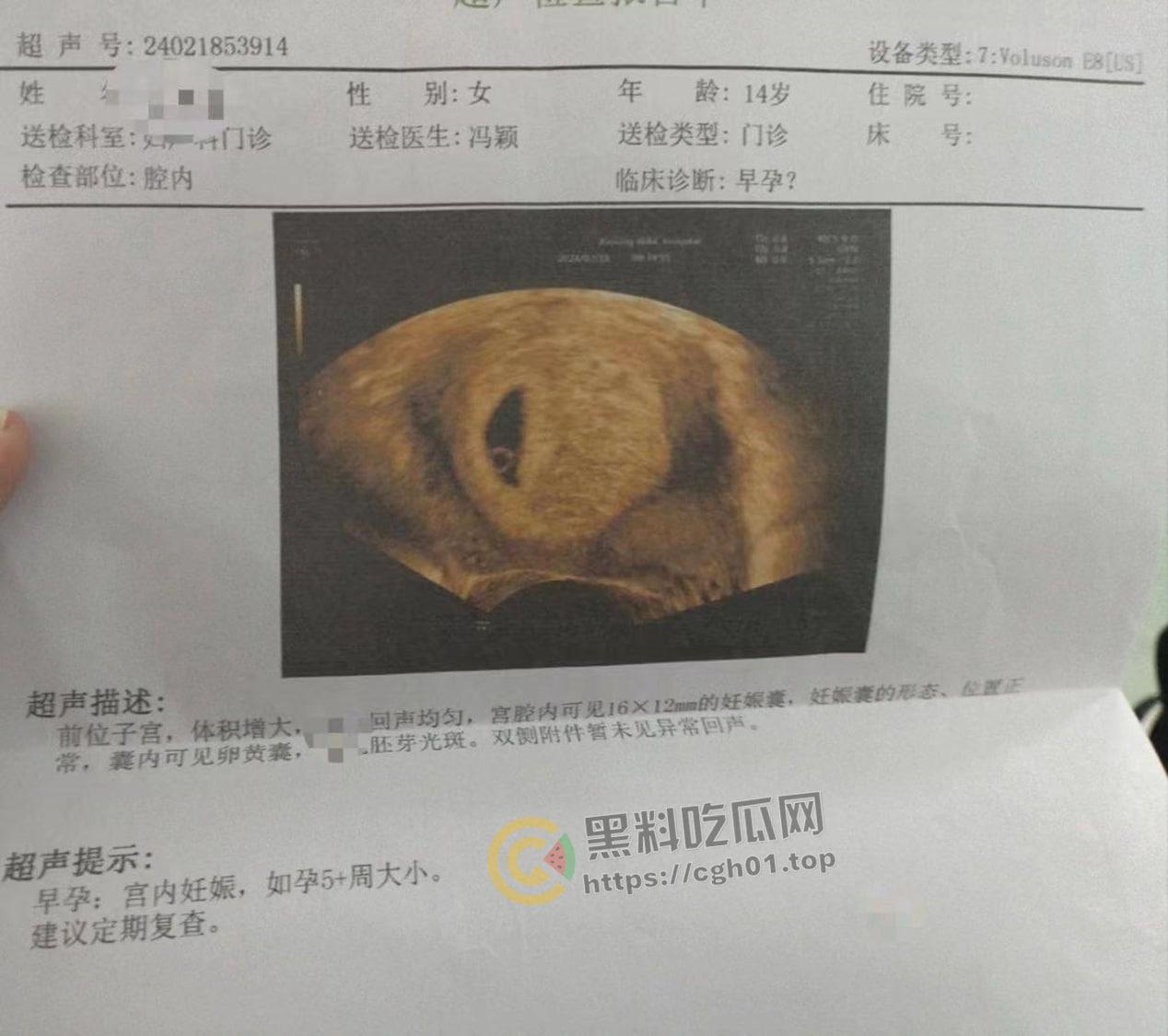 初中生小畜生【黄明昊】把女朋友搞怀孕 逆天发言生出来就踹死  第1张