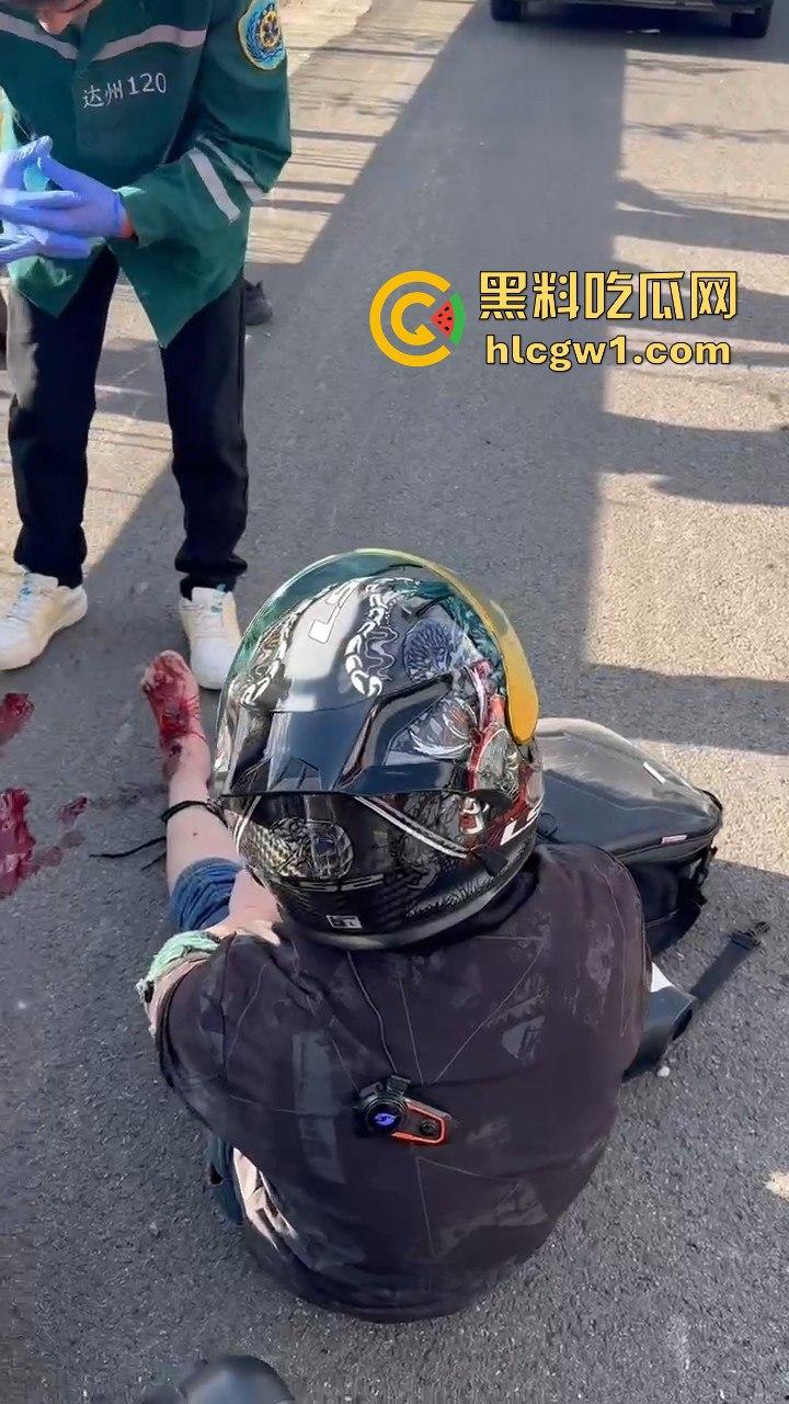 辽宁小车司机路怒找茬摩托骑手！以为没行车记录仪，直接上去撞，结果笑死了！  第5张