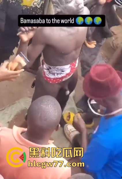 非洲部落割包皮 这也太生猛了吧 包皮一拉一刀下去直接割掉 这老哥全程面无表情！  第3张